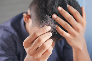 Post: Common Questions That People Ask About Hair Loss