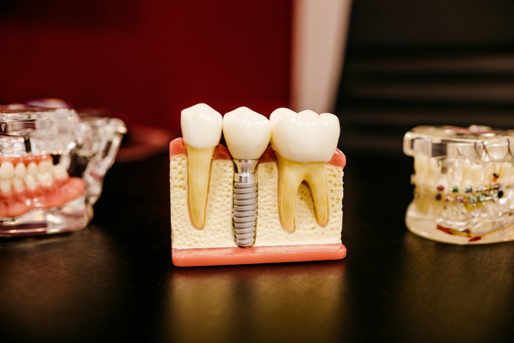 How to Ensure You Have a Well-Equipped Dental Practice